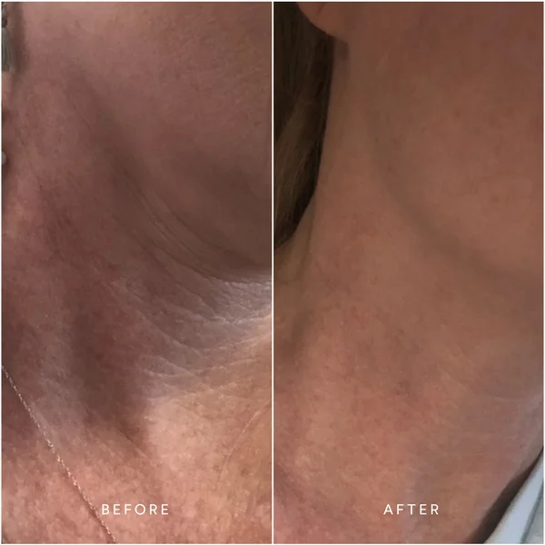 True Botanicals Renew Repair Nightly Treatment 30ml